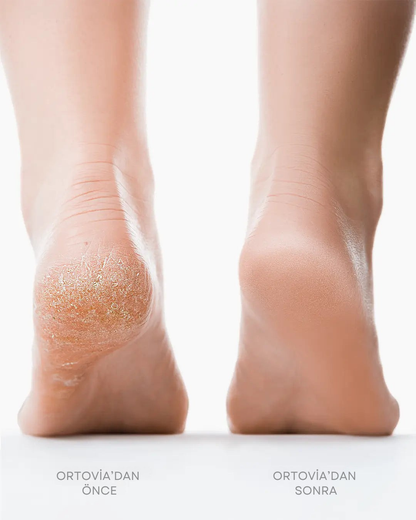 Ortovia SilkStep Pro®